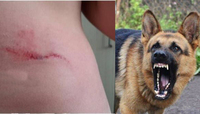 Собака на Полтавщині покусав дитину. У поліції кажуть, що пес «вдарив зубами» (ФОТО)