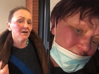 Били по голові, зірвали перуку: у Франції 20 підлітків жорстоко побили хвору на рак росіянку (ФОТО/ВІДЕО)