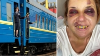 Через жорстоке побиття журналістки в «Укрзалізниці» звільнять купу народу 