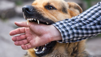 Дражнили прив'язану собаку: подробиці нападу пса на дитину у Костополі