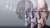Нейрогенетик розповіла, чи можна визначити загрозу хвороби Альцгеймера