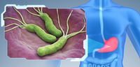 Бактерія гелікобактер може викликати рак 