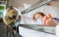 Малюка з рідкісним «синдромом вампіра» покинули в лікарні. ФОТО 18+