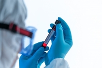 На Рівненщині — пів сотні нових підтверджених випадків захворювання на коронавірус, — Коваль
