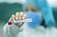 Жінка померла від коронавірусу, за минулу добу 73 особам діагностовано хворобу у Рівненській області