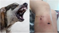 У Нетішині пес пошматував ногу 10-річному хлопчику. Рани глибокі (ФОТО)