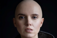 Відома телеведуча розповіла про боротьбу з раком