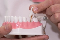 Учасників АТО Рівного хочуть по-новому забезпечувати зубними протезами