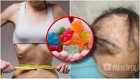 Усе почалось з бажання схуднути: 13-річні дівчата з Прикарпаття облисіли через вітамінки-ведмедики (ФОТО)