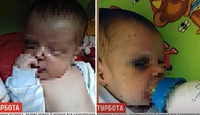 Немовля не могло дихати через кров у носі. Мати покинула травмовану дитину у Рівному  