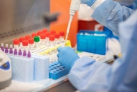Скільки на Рівненщині є тестів для визначення коронавірусу 