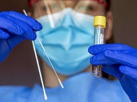 Чому здачі першого тесту на коронавірус на Рівненщині треба чекати від 3 до 7 днів