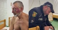 61-річного майора жорстоко побили на Рівненщині: деталі інциденту (ВІДЕО)