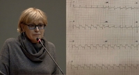Дочка Миколи Амосова поставила під сумнів вплив саме COVID-19 на інфаркти міокарду? (ІМ)