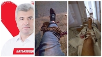 Депутат отримав відкритий перелом на вулиці м. Рівне (ФОТО)