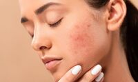 5 помилок в очищенні шкіри обличчя, які призводять до висипань, акне і ранніх зморщок