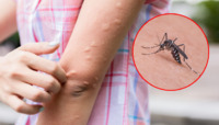 Ефективний захист від комарів можна зробити вдома. Поради біохіміка (РЕЦЕПТ)