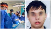 Це ДИВОВИЖНО: медики зі Львова заново зібрали обличчя 20-річному юнаку: ФОТО до та після