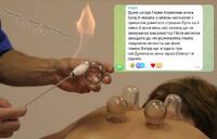 Смертельний масаж у Франківську: Лікар під час сеансу підпалила клієнтку. Та не вижила (ФОТО)