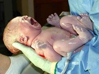 Немовля у «сорочці»: у Рівненському перинатальному показали, як може народитися дитина (ФОТО)
