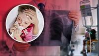 На Волині спалах туберкульозу: померла 4-річна дівчинка (ВІДЕО)