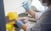 У Рівне везуть тест-системи на виявлення коронавірусу, – МОЗ