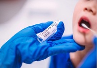 Майже пів тисячі випадків COVID-19 зареєстрували на Рівненщині