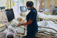 У мешканця Рівненщини виявили бактерію, яка спричинила запалення мозку: Діагноз шукали майже 1 місяць