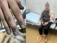 Служити вже не будуть, бо пообрізають пальці? Біля кордону на Рівненщині затримали чоловіків (ФОТО)