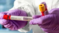 На Рівненщині семеро людей померли від ускладнень коронавірусу 