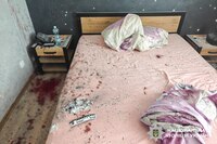 Студент втратив частину руки, а у дівчини - важкі травми: на Рівненщині вибухнула граната (ФОТО)