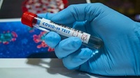 На Рівненщині померло п'ятеро людей, у яких діагностували коронавірус
