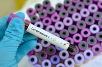 Вакцину від «китайського» коронавірусу продають винахідливі українці на OLX 