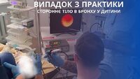 Дитину 1,7 року нагодували соняшниковим насінням: Результат - у Рівному провели операцію (ФОТО)