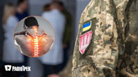 Мобілізація в Україні: які хвороби хребта можуть звільнити від військової служби? 