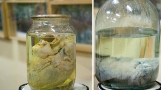 Серце алкоголіка (ліворуч) та легені курця (праворуч)