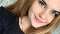 18-річна красуня з Рівненщини бореться за життя. Терміново треба гроші у боротьбі з онкологією (ФОТО)