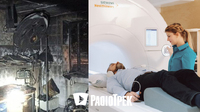 Апарат МРТ може вибухнути при аварійному відключенні світла: Яких заходів вживають на Рівненщині