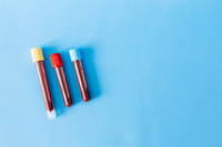 Нерви, як сталеві канати: власники якої групи крові живуть найдовше 