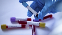 У Сарненській лікарні перевірили 9 медиків на коронавірус