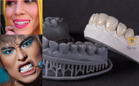 6 найнебезпечніших стоматологічних трендів TikTok, які можуть зіпсувати зуби