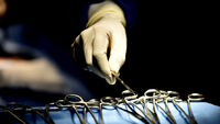 Лікарі знайшли в серці чоловіка шматок цементу (ФОТО)