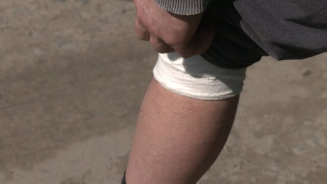 Андрій показує поранене коліно. Фото - Суспільне. 