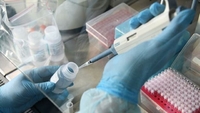 Додаткові лабораторії для ПЛР-тестування на коронавірус підключають на Рівненщині