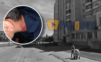 Стрілянина на Ювілейному: дитині поцілили в голову (ФОТО)