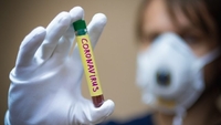 Понад 50 нових випадків захворювання на коронавірус виявили на Рівненщині 