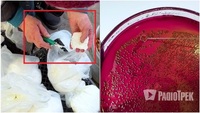 «Бал зарази»: хімік показав під мікроскопом, що «живе» у молочці, яку продають на ринках (ВІДЕО)