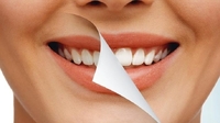 Стоматологиня розповіла, що насправді найбільше шкодить зубній емалі