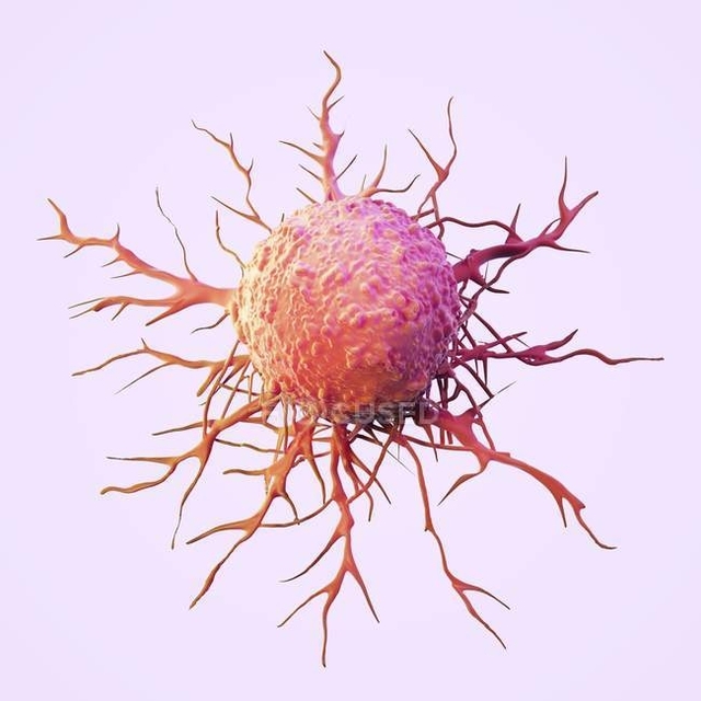 Ракова клітина зі "щупальцями". Фото ілюстративне