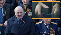 Диктатор при смерті? На що хворий Лукашенко (ФОТО)